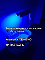 Лампа Philips для лечения желтухи у малышей дома. Аренда. Lampă pentru tratamentul icterului acasă. - Изображение 3