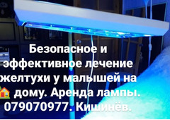 Медицинская лампа для лечения желтухи у малышей дома! Аренда! - Изображение 3