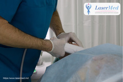 Tratamentele cu laser CO2 fractional in combinatie cu terapia PRP in Moldova!