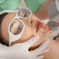 Tratamentele cu laser CO2 fractional in combinatie cu terapia PRP in Moldova! - Изображение 3