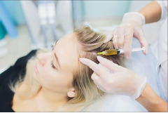 Tratamentul PRP împotriva căderii părului la cabinetul chirurgie estetica "LaserMed"! - Изображение 8