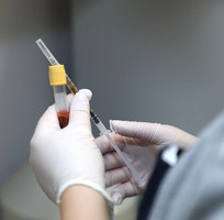 PRP (Propia plasma bogata in trombocite). Tratament impotriva caderii parului in Chisinau! - Изображение 6
