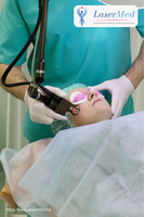 Tratamentele faciale cu laser CO2 fractional in combinatie cu terapia PRP in Moldova!