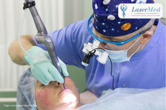 Inlaturarea cu laser a verucilor, papiloamelor, negilor condiloamelor in   (Chisinau) Moldova ! - Изображение 2