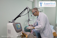 Indepărtarea (eliminarea, inlaturarea) alunitelor (nevilor) cu laser in Chisinau, Moldova!