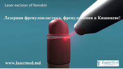 Лазерная френулопластика, френулотомия в Кишиневе! - Изображение 2