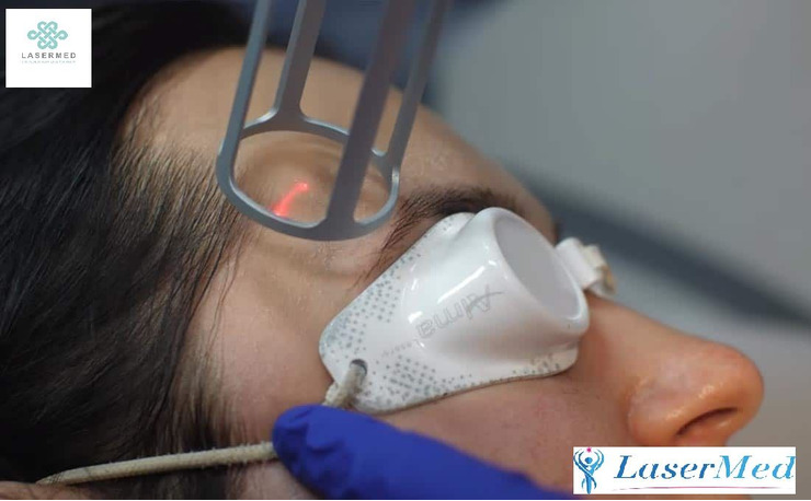 Blefaroplastia cu laser a pleoapelor superioare și inferioare — 10% reducere! — foto 2
