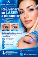 Blefaroplastie cu laser : Chirurgia laser estetica a pleoapelor