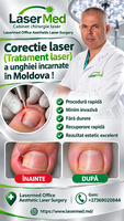 Corectie laser (Tratament laser) a unghiei incarnate in Chisinau, Moldova!