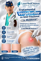 Лазерное удаление растяжек и стрии в кабинете лазерной хирургии ''LaserMedChisinau” в Молдове!